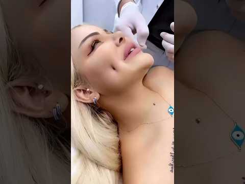 "Shocking ...New Dimple hacks 😱#makeuphacks #shorts #youtubeshorts