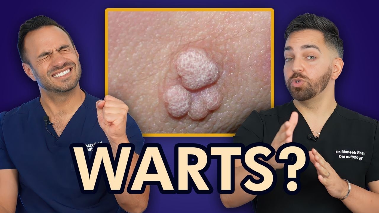 Treat Warts Like a Dermatologist 🩺