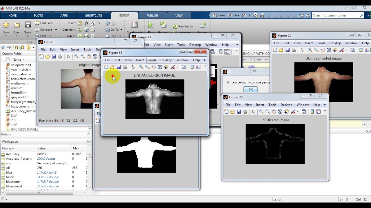 Advanced Criminal Identification Using Skin Marks & Vein Pattern Fusion in Color Images ๐