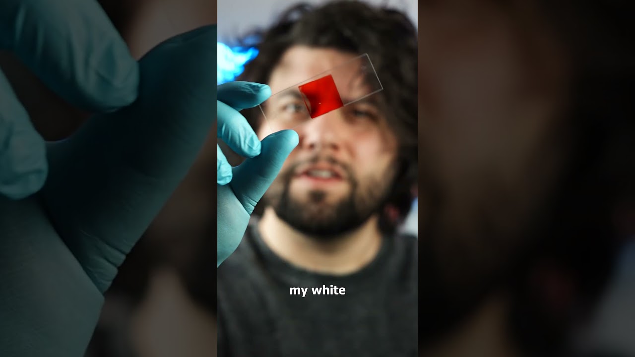 White Blood Cells vs Still Water Microbes 🧬