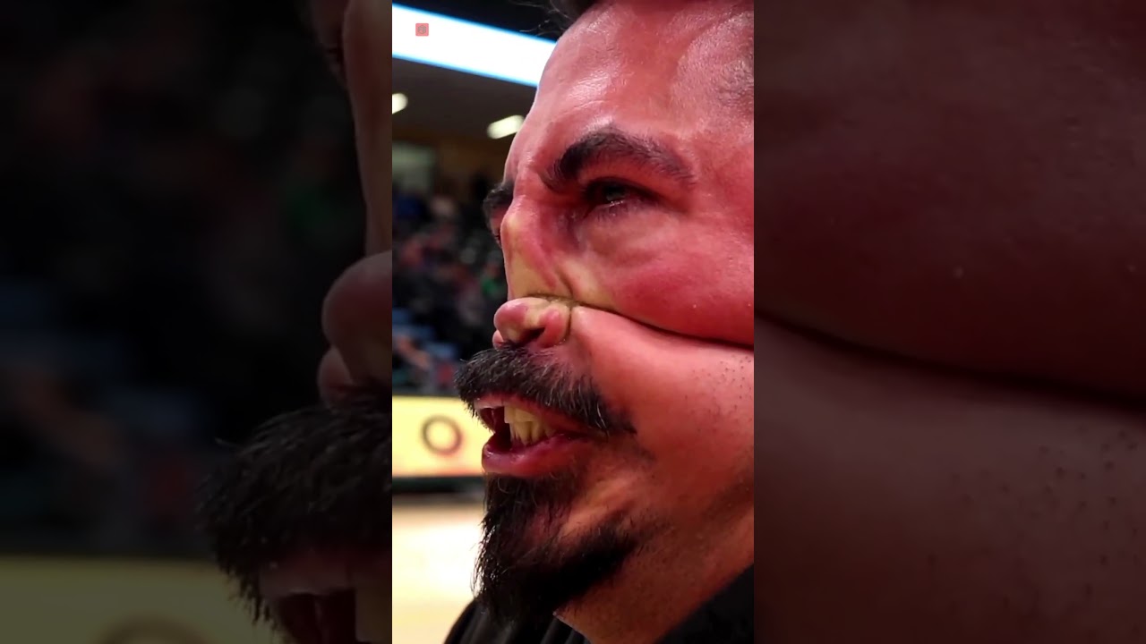 Unbelievable Olympic Event: Nose Pulling Challenge! π²