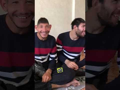 Deux frères sont nés avec une maladie rare et ont été abandonnés par leurs parents.