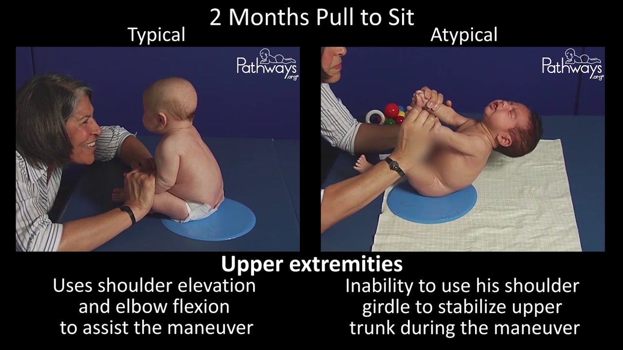 2-Month-Old Baby Development: Typical vs Atypical ๐ผ