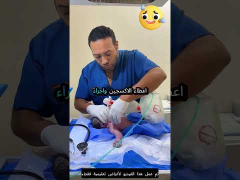 الطبيب أنقذ حياة الطفل! 👨‍⚕️👶
