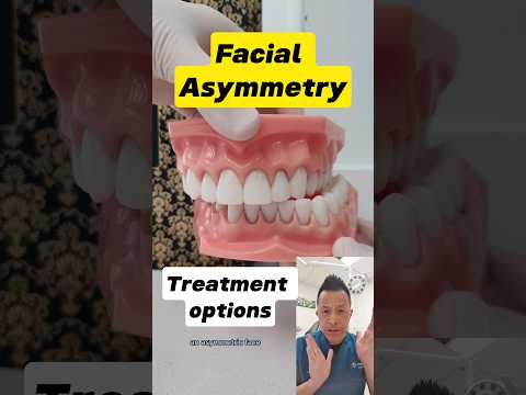 Facial Asymmetry Treatment: What Are Your Options? #dentallan #dentist #shorts