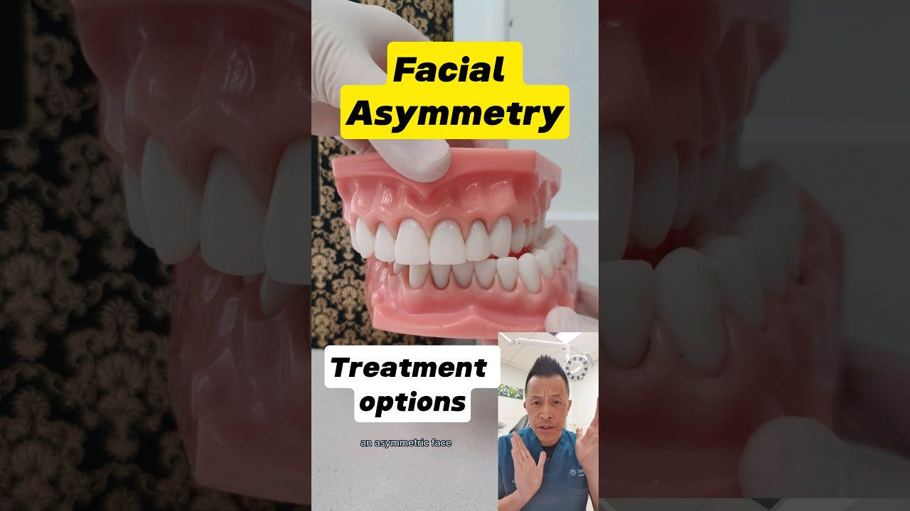 Effective Treatments for Facial Asymmetry 😊 | Fix Your Smile