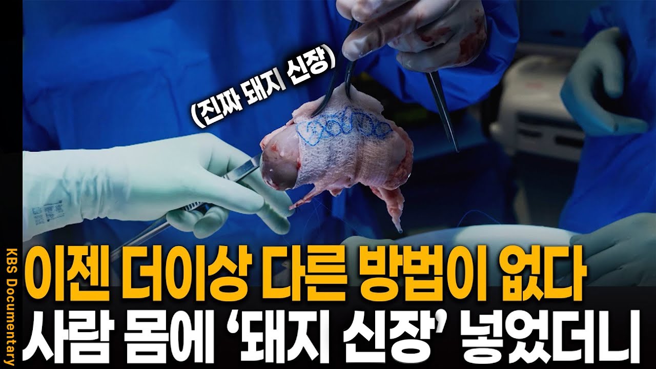 KBS 대기획 트랜스휴먼 3부: 유전자 혁명 🚀