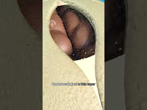 Why Does a Baby’s Soft Spot Moves 👶 - Baby’s Fontanelle #short - Creativelearning3d