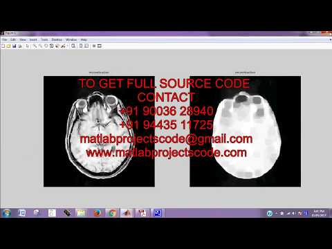 The Connected Brain:Causality models and intrinsic dynamics