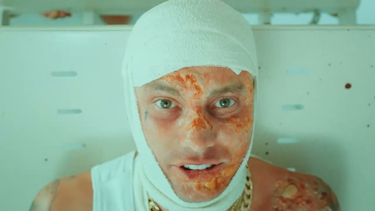 Kerser - Winner 🎶