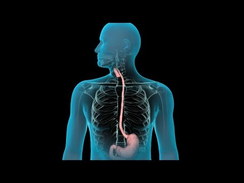 Upper GI Endoscopy Overview 🩺