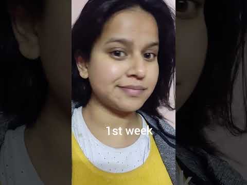 Before and after vitamin c serum #shorts #skincare #beforeandafter