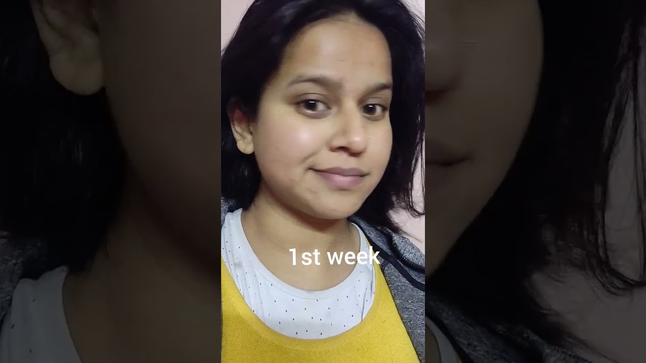 Transform Your Skin with Vitamin C Serum ✨ | Before & After Results #Shorts