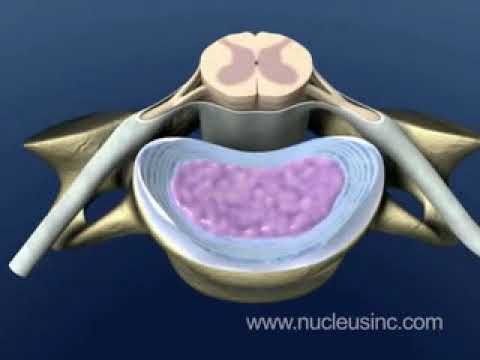 Anatomy of the Spine - NUCLEUS Medical Media