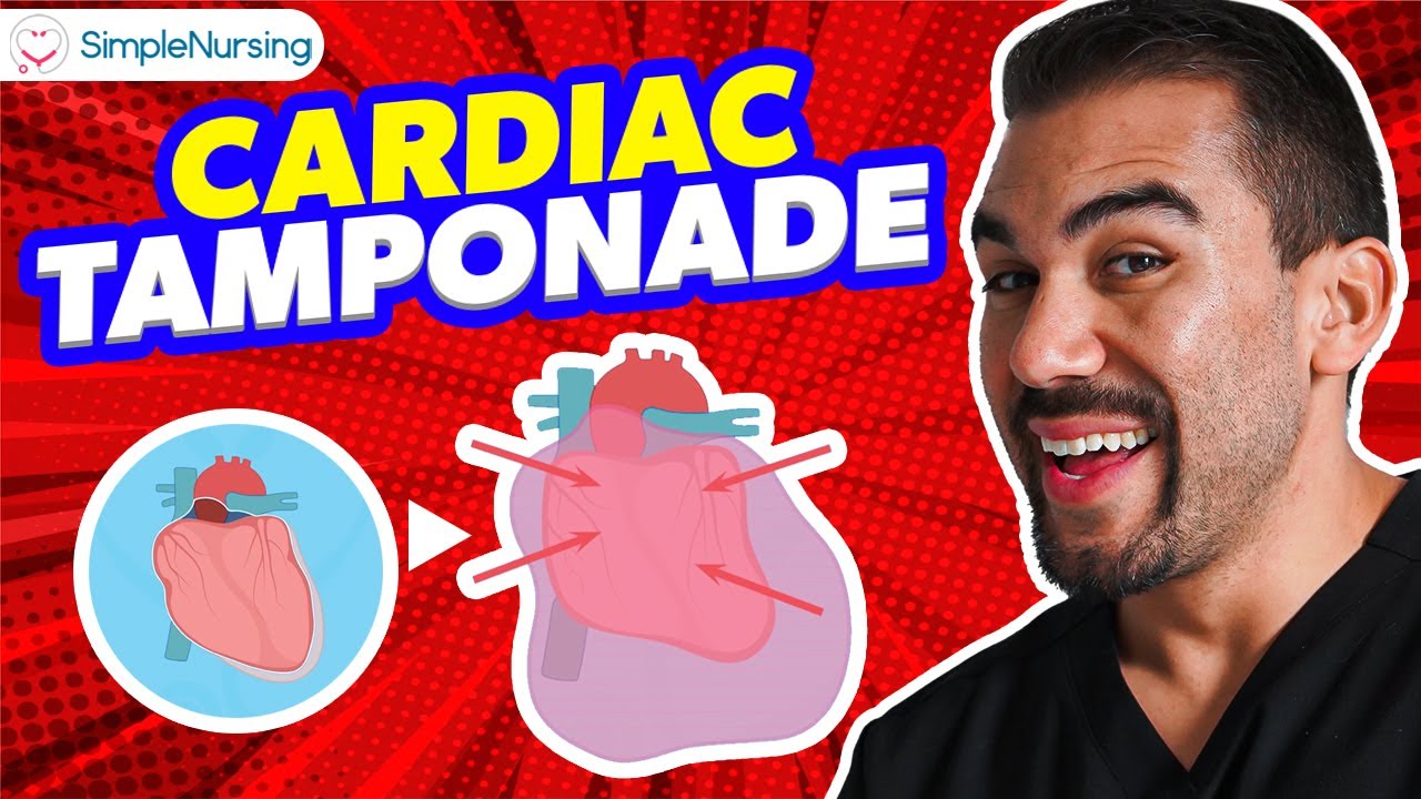 NCLEX Tips for Cardiac Tamponade 🩺