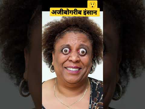 दुनिया के 5 सबसे अजीबो-गरीब इंसान 🙄😲