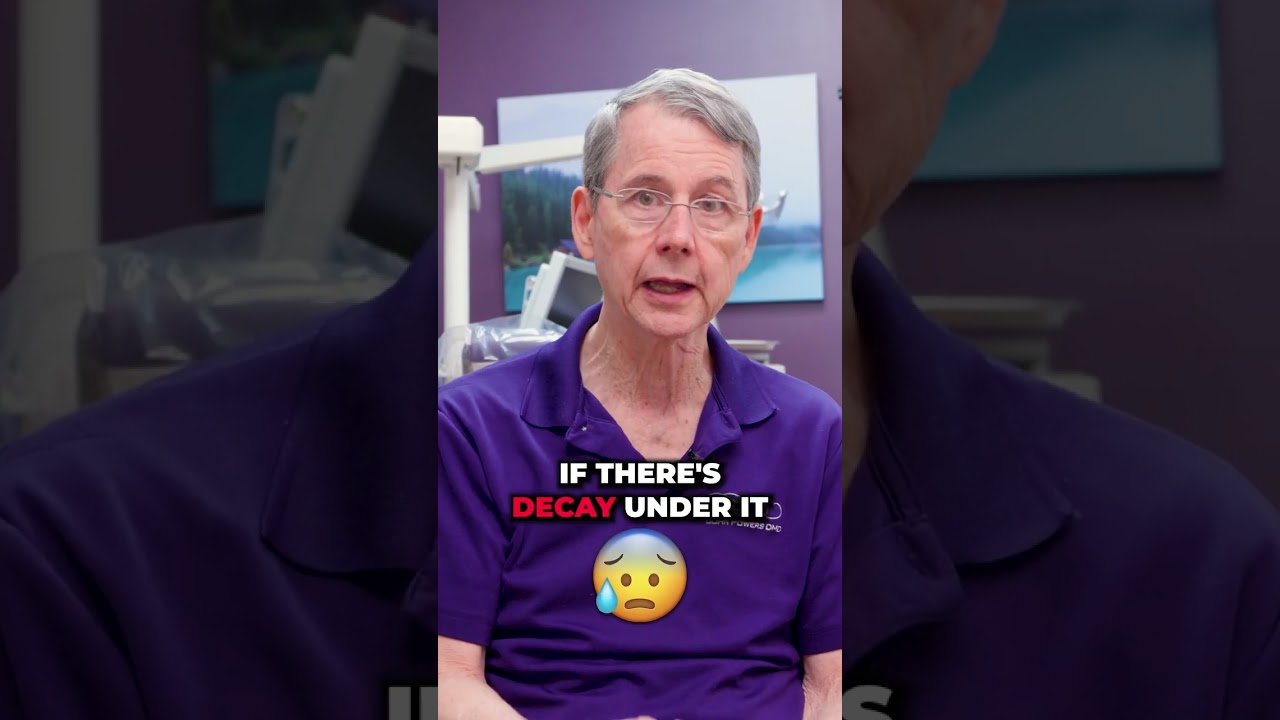 When to Replace Your Dental Crowns 🦷