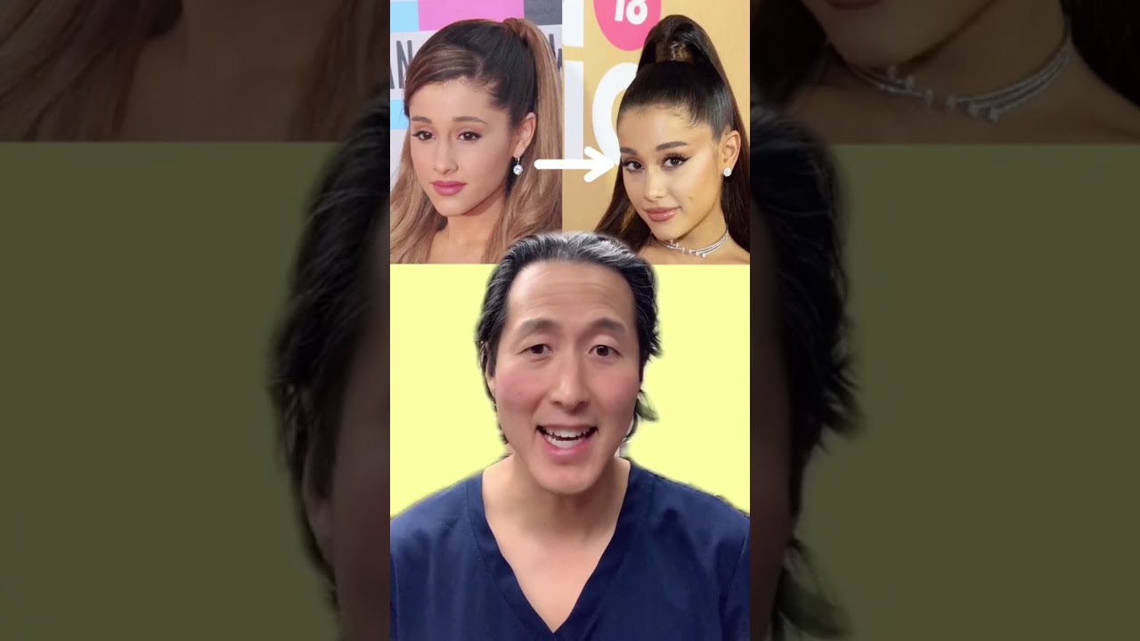 Did Ariana Grande Get Plastic Surgery? 🤔