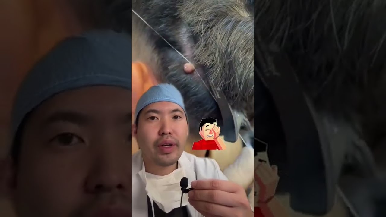 Removing Moles at the Barber with String? 🚫