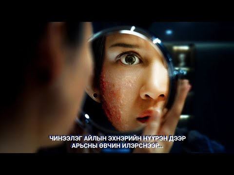 ЧИНЭЭЛЭГ АЙЛЫН ЭХНЭРИЙН НҮҮРЭН ДЭЭР АРЬСНЫ ӨВЧИН ИЛЭРСНЭЭР...
