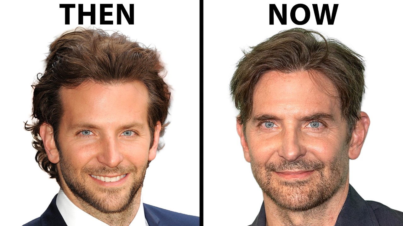 Bradley Cooper's NEW FACE | Plastic Surgery Analysis
