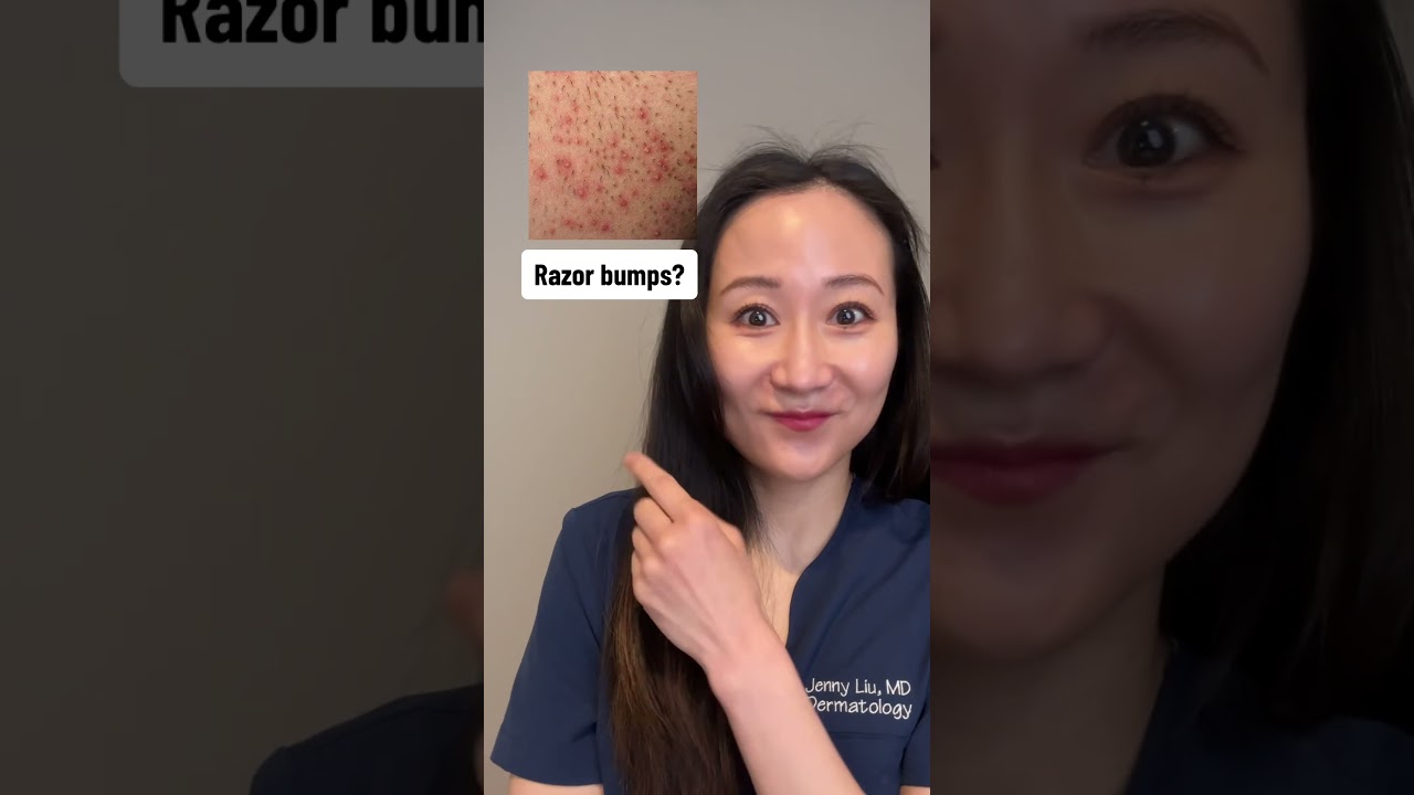 #skincare #skincareroutine #dermatology #dermatologistskincare #skincaretips #skincarehack