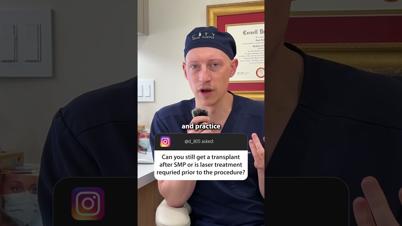 Hair Transplant After Scalp Micropigmentation? 🤔