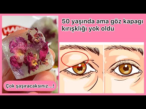 50 Yaşında Ama Bu Maske ile Göz Kapağı Düşüklüğü Kırışıklıklar Gitti 30 Yaşında Kadına Benziyor