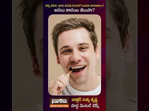 డాక్టర్ గారు, నా క్రింది పళ్ళ వెనుక భాగం ఎందుకు పసుపు రంగులోకి మారుతోంది? — చాలా మంది అడిగే ప్రశ్న!