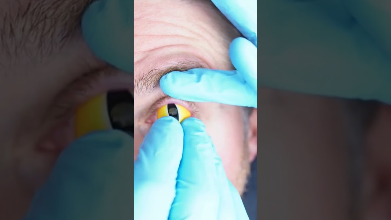 How to Insert Large Sclera Halloween Contacts 😎
