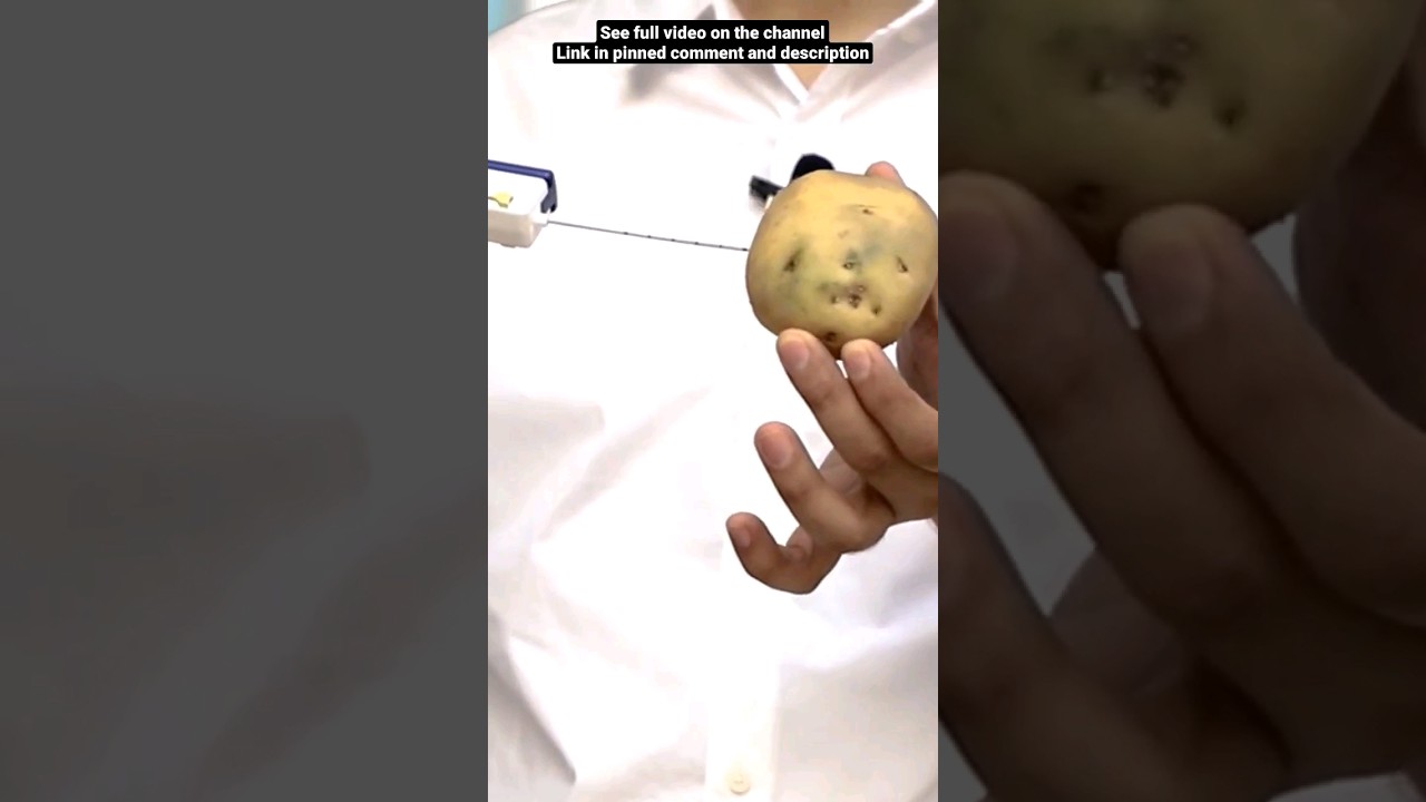Biopsy for Cancer Diagnosis Explained with a Potato Demo 🍠 | Dr. Gaurav Gangwani
