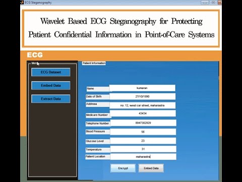 ECG Steganography for Protecting Patient Confidential Information Matlab Project