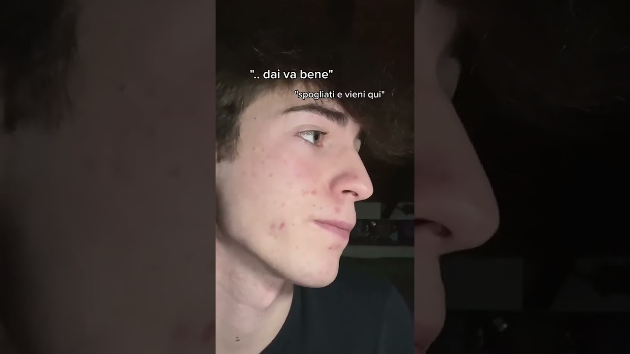 Epic LOLLO RARO Video 🤯 | Lacustre Clips You Can't Miss!