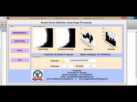 Matlab code for Breast Cancer Detection using Image Processing | Breast Cancer Classification