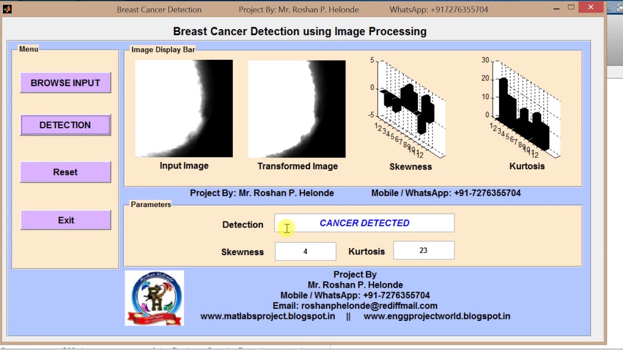 Matlab code for Breast Cancer Detection using Image Processing | Breast Cancer Classification