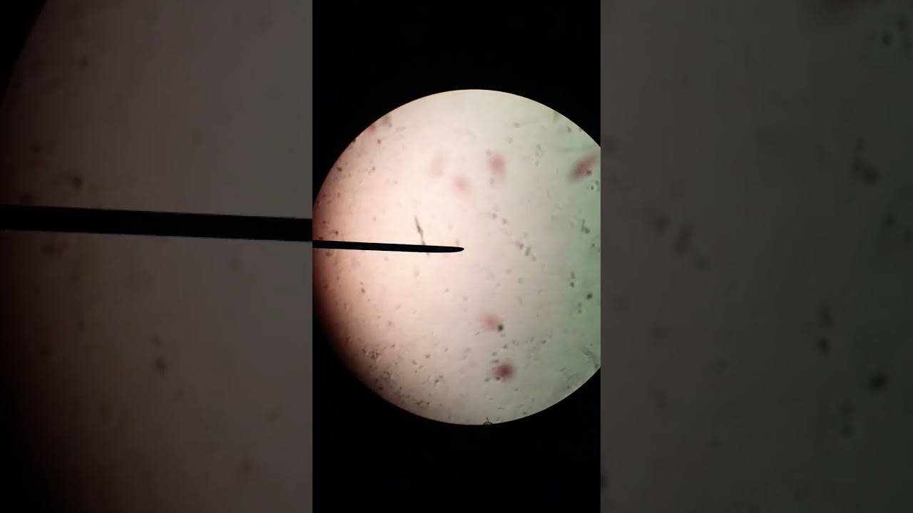 Ameba: Microbiology and Medical Relevance 🦠