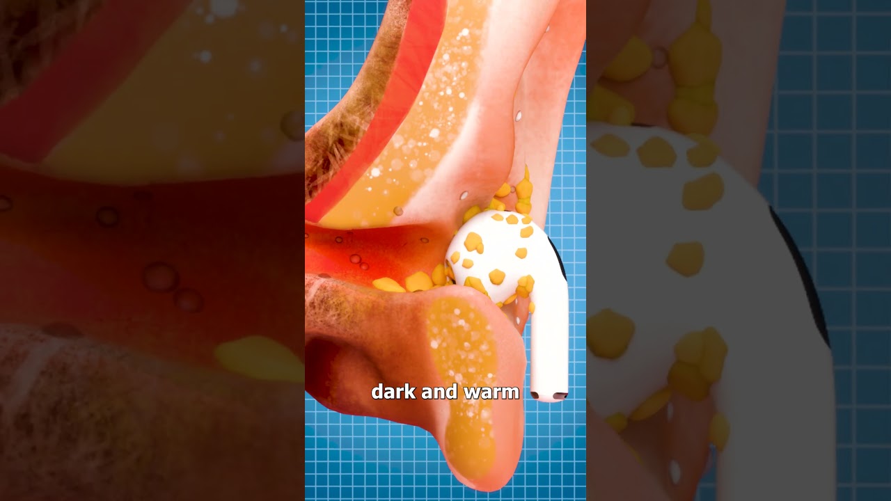 Shocking Reasons Your Earbuds Are Dirty & How to Clean Them 🧼