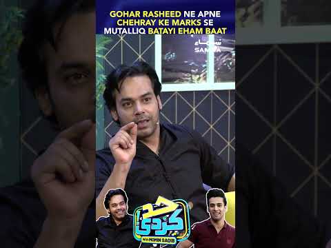 Gohar Rasheed Ne Apne Chehray Ke Marks Se Mutalliq Batayi Eham Baat