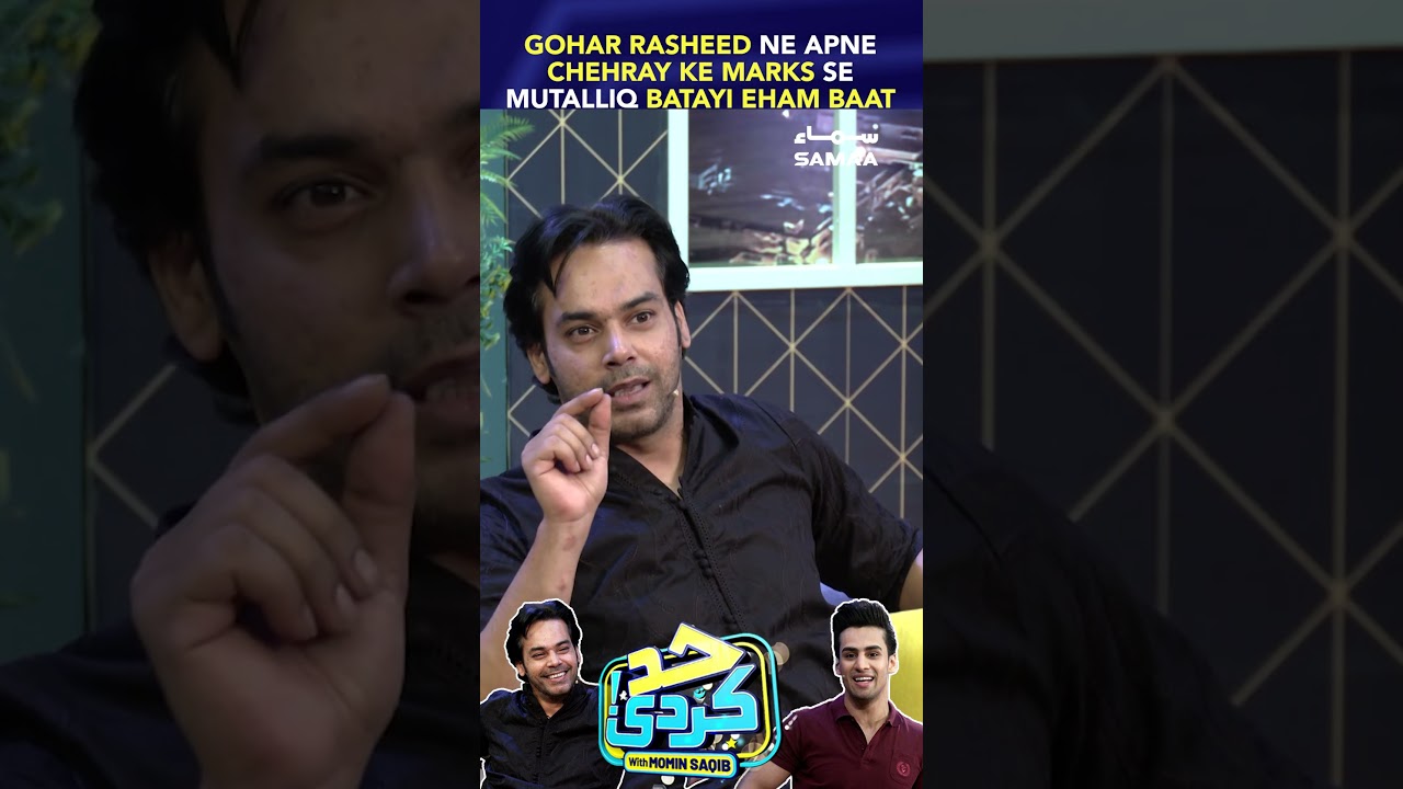 Gohar Rasheed Reveals Surprising Details About His Facial Marks ✨