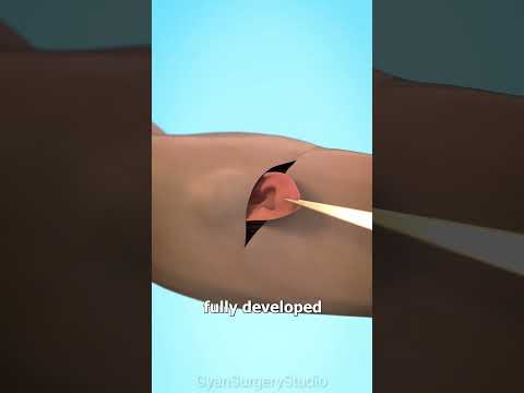 What happens if your ear is cut off?😨(3D Animation) #shorts #science #3danimation #hindi