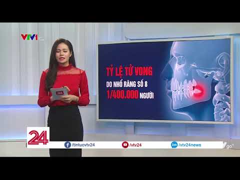 Thận trọng khi nhổ răng khôn số 8 - Tin Tức VTV24