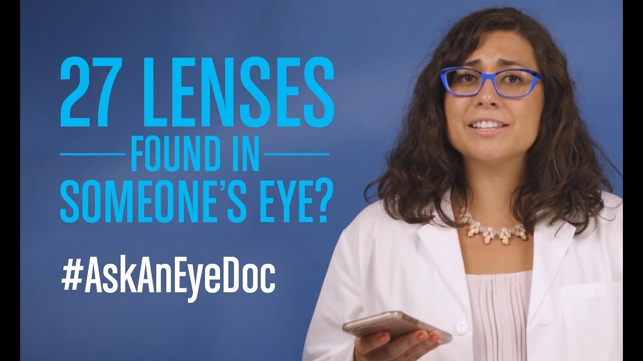 How Did 27 Contact Lenses Get Stuck in One Eye? ποΈ