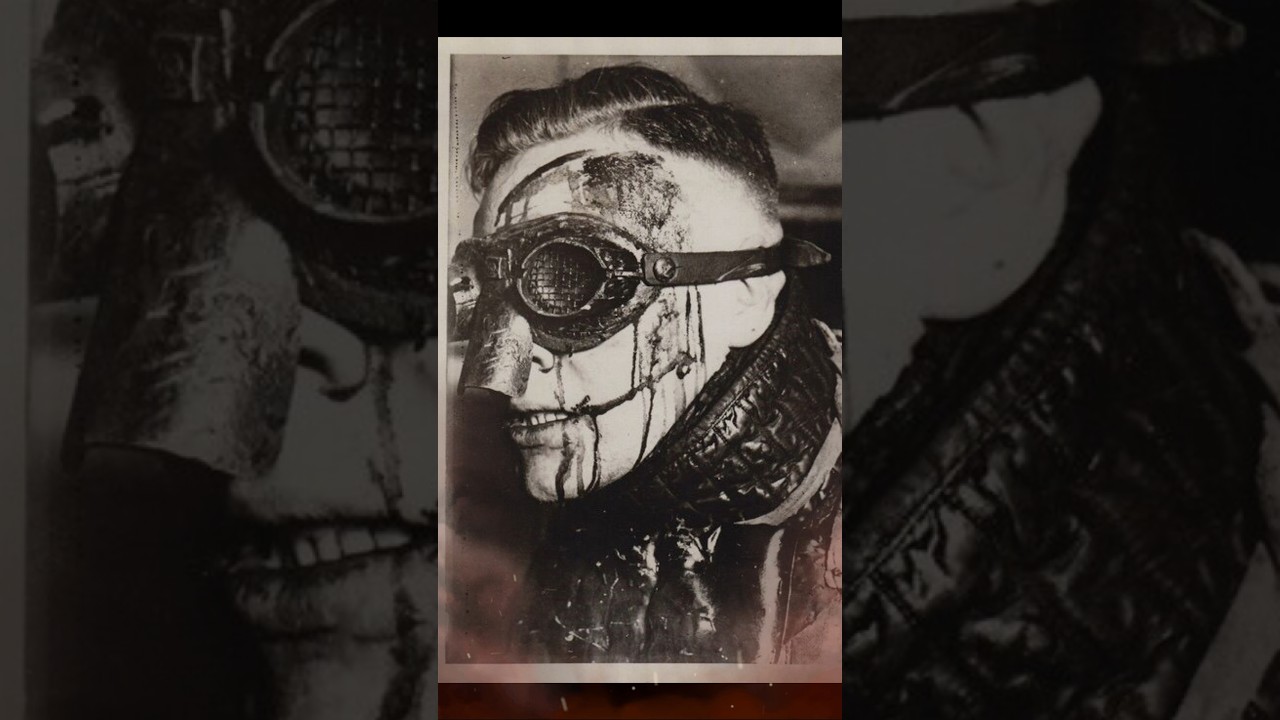 Uncovering the Mystery: Why Many German Officers in WWII Had Facial Scars 🕵️‍♂️