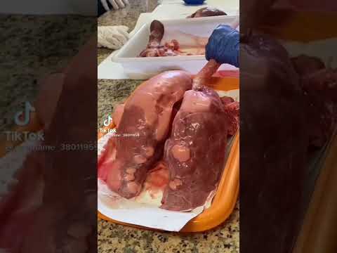 AIIMS Delhi😍, Doctor Status❤️, Dream🔥 College, NEET aspirant Motivational🔥 Video MBBS DOCTOR, #short