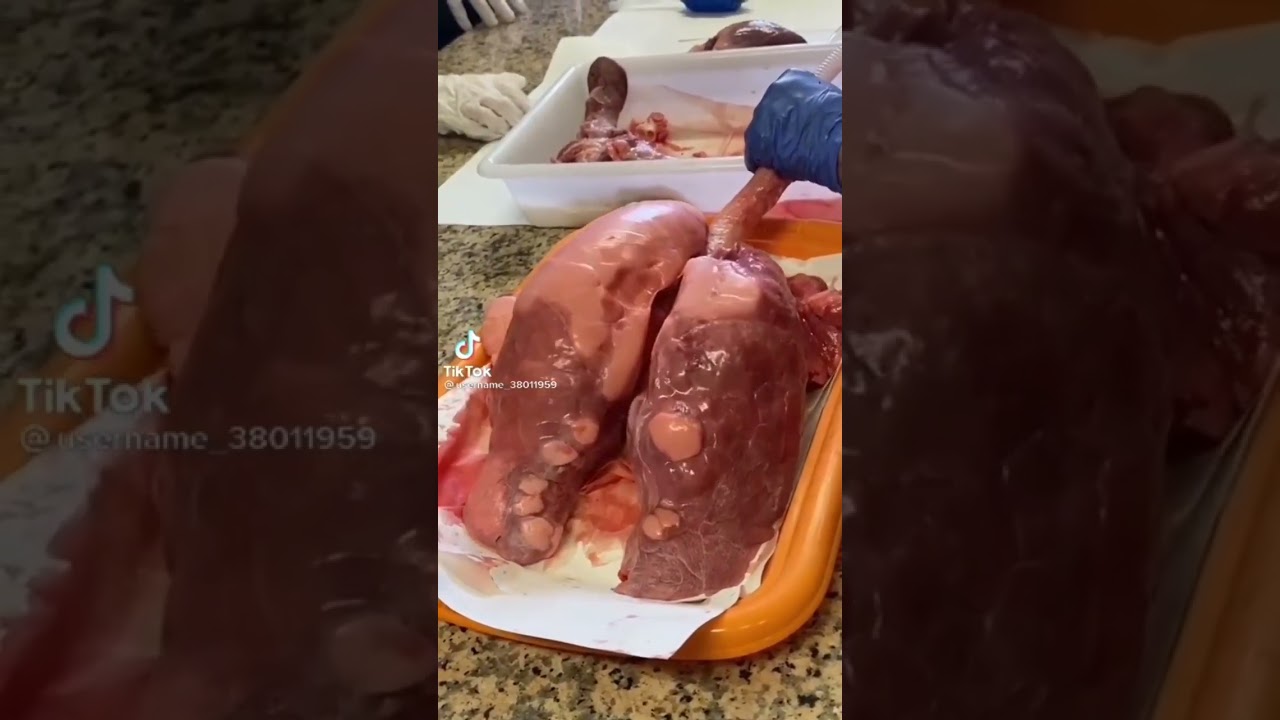 Achieve Your Dream of AIIMS Delhi! 🚀 Motivational Tips for NEET Aspirants