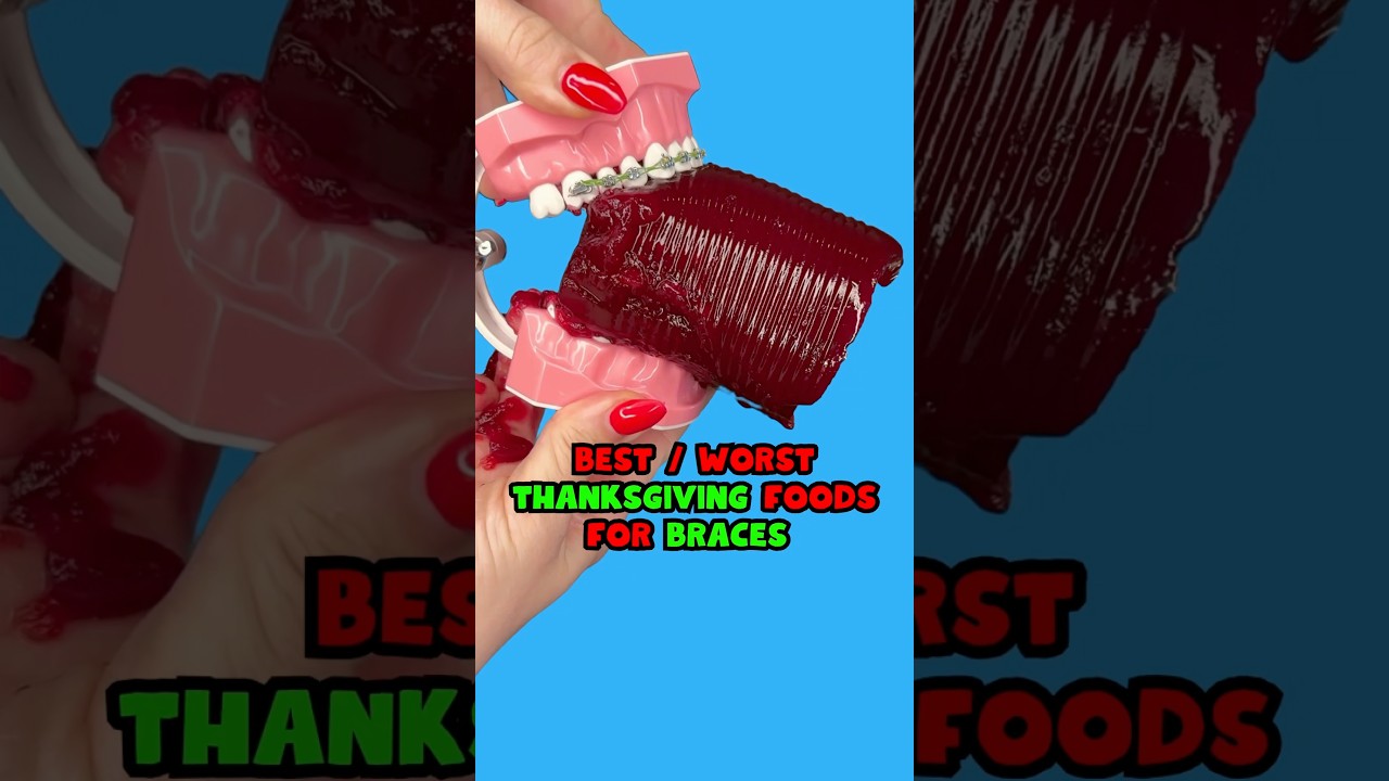 6 BEST and WORST Thanksgiving DINNER foods for braces 👀 #braces #dinner #asmrfood