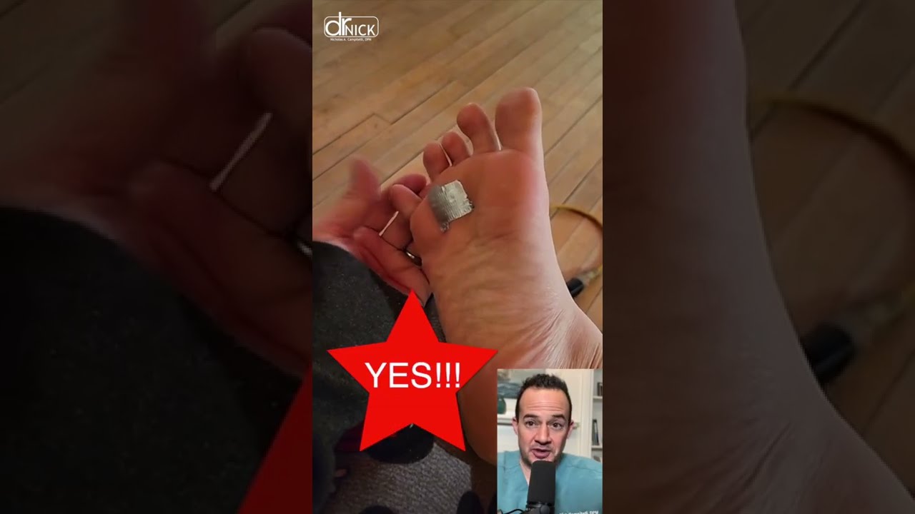 Doctor Reacts to Plantar Warts & Duct Tape Treatment