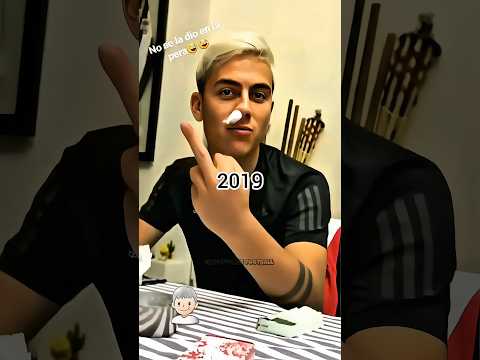 Dybala Evolution 🥵💩