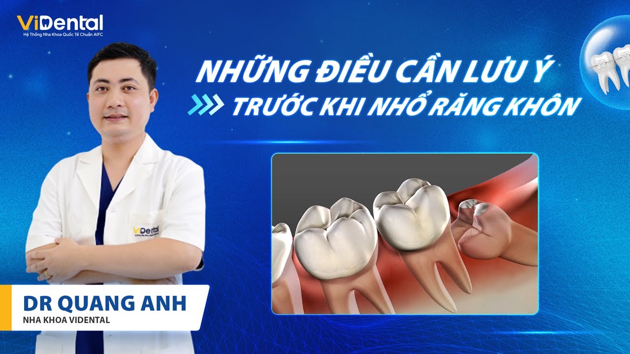 Những Điều Cần Chuẩn Bị Trước Khi Nhổ Răng Khôn | Nha Khoa ViDental