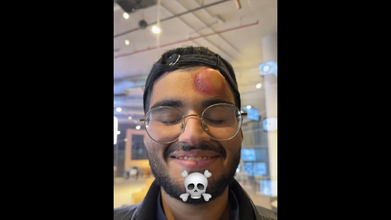 Players with Incredible Shot Power Featuring Ronaldo